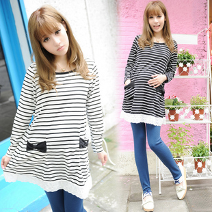 Maternity clothing spring and autumn long-sleeve maternity t-shirt loose long design top lace stripe maternity dress 3019