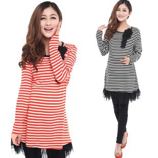 Maternity clothing stripe one-piece dress maternity clothing spring and autumn basic shirt spring fashion maternity top